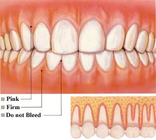Healthy Gums
