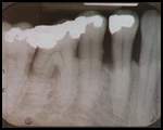 X-Ray